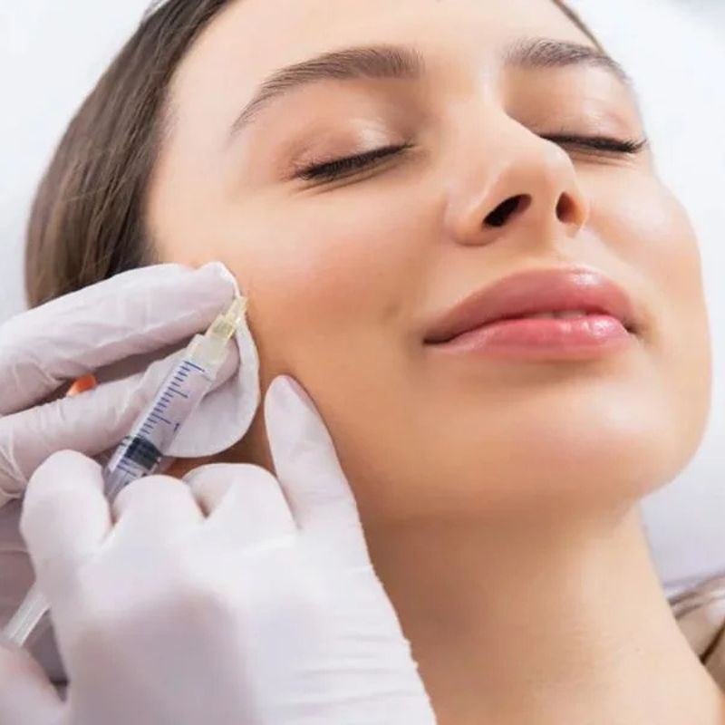 Lip Filler