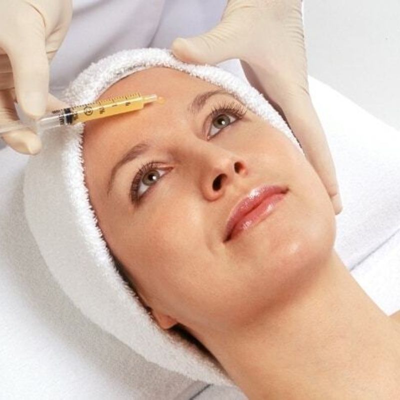 Platelet Rich Plasma