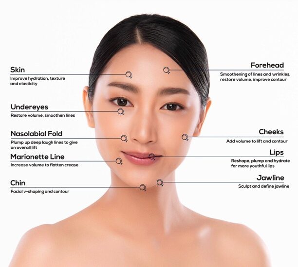 Dermal Filler Treatment areas