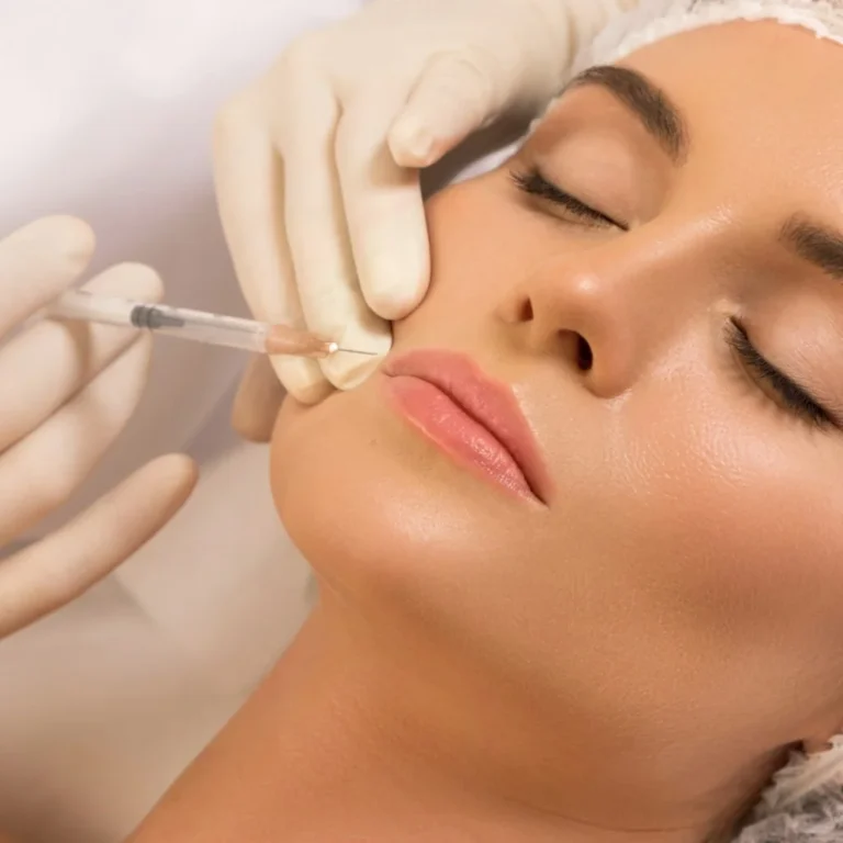 Dermal Filler Treatment areas