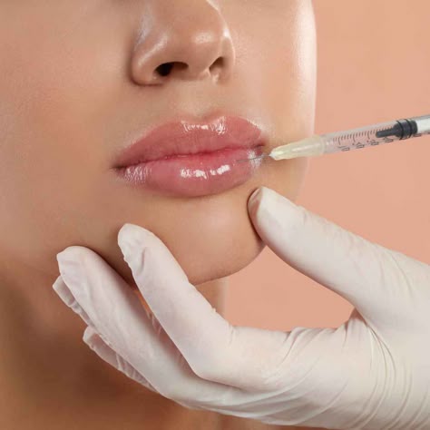 Lip Filler